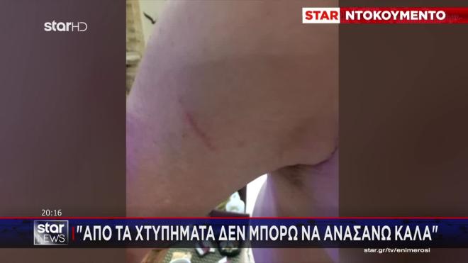 Κερατσίνι: Άγριο ξύλο με σιδερογροθιές για μία παρατήρηση - Βίντεο