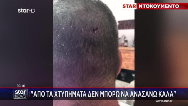 Κερατσίνι: Άγριο ξύλο με σιδερογροθιές για μία παρατήρηση - Βίντεο