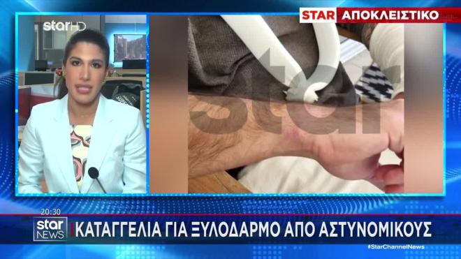 Καταγγελία για ξύλο από αστυνομικούς