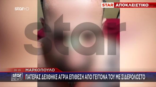 Μαρκόπουλο: Πατέρας δέχθηκε άγρια επίθεση από γείτονά του με σιδερολοστό