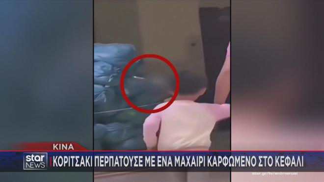 Το κοριτσάκι ενώ περπατά με τη μητέρα του με μαχαίρι καρφωμένο στο κεφάλι του!  