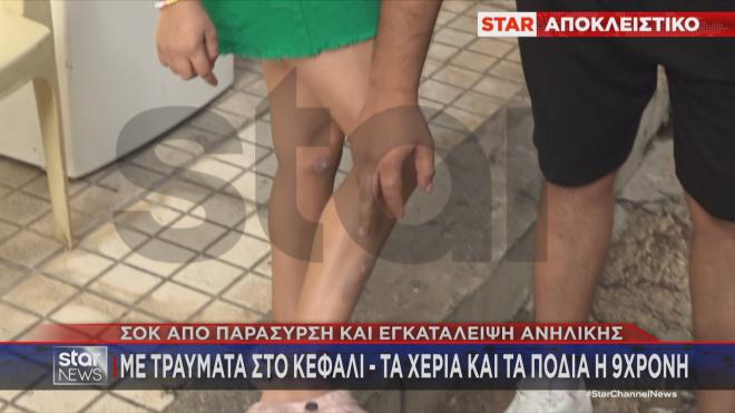 Τραύματα στο κεφάλι και το χέρι για την 9χρονη μετά την παράσυρση 