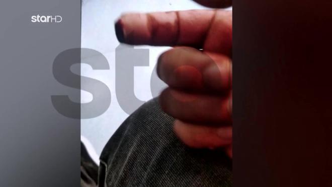 Του έκοψε το δάχτυλο και το κράτησε στην κατάψυξη 