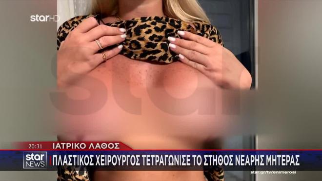 κατέληξε με παραμορφωμένο στήθος, αντιαισθητικές ουλές και λοίμωξη από σταφυλόκοκκο