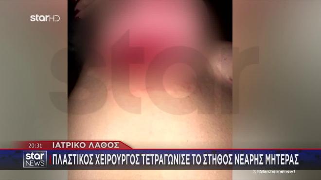 Πλαστικός χειρουργός «τετραγώνισε» το στήθος νεαρής μητέρας 
