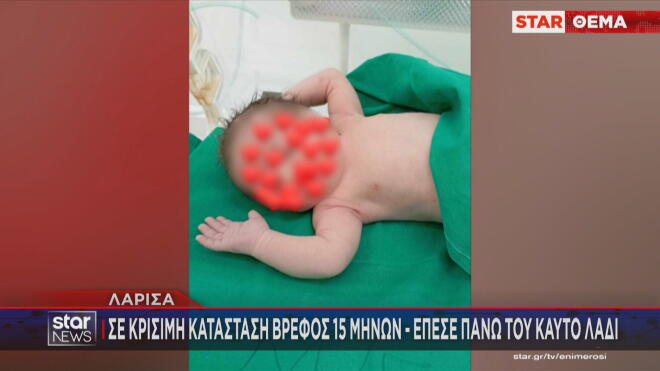 Στην εντατική του Πανεπιστημιακού Νοσοκομείου Λάρισας νοσηλεύεται ένα βρέφος 15 μηνών καθώς έχει υποστεί πολύ σοβαρά εγκαύματα από καυτό λάδι