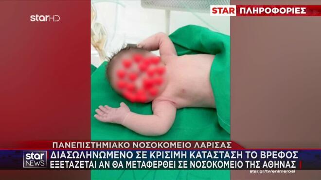 μωρό εγκαύματα Καρδίτσα 1