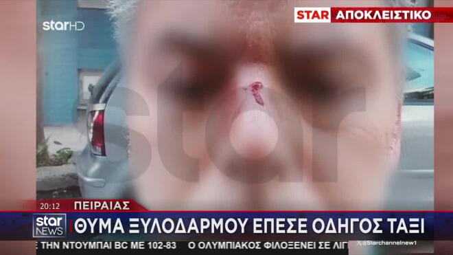 Πειραιάς: Θύμα άγριου ξυλοδαρμού έπεσε οδηγός ταξί