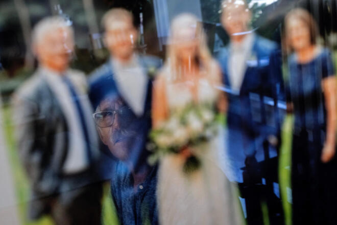 Όταν το ανοσοποιητικό «επιτίθεται» στον εγκέφαλο & σκοτώνει τις αναμνήσεις