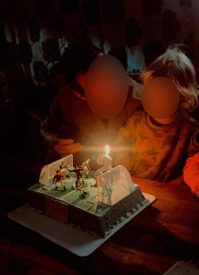 O 2χρονος που κατασπαράχθηκε από σκυλί στη Ζάκυνθο 2