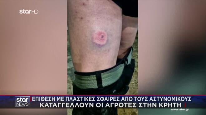Τα σημάδια από τις πλαστικές σφαίρες