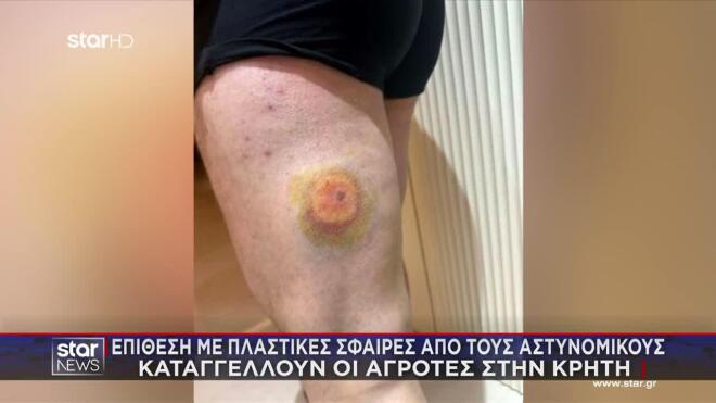 Κρήτη: Αγρότες καταγγέλλουν επίθεση από αστυνομικούς με πλαστικές σφαίρες