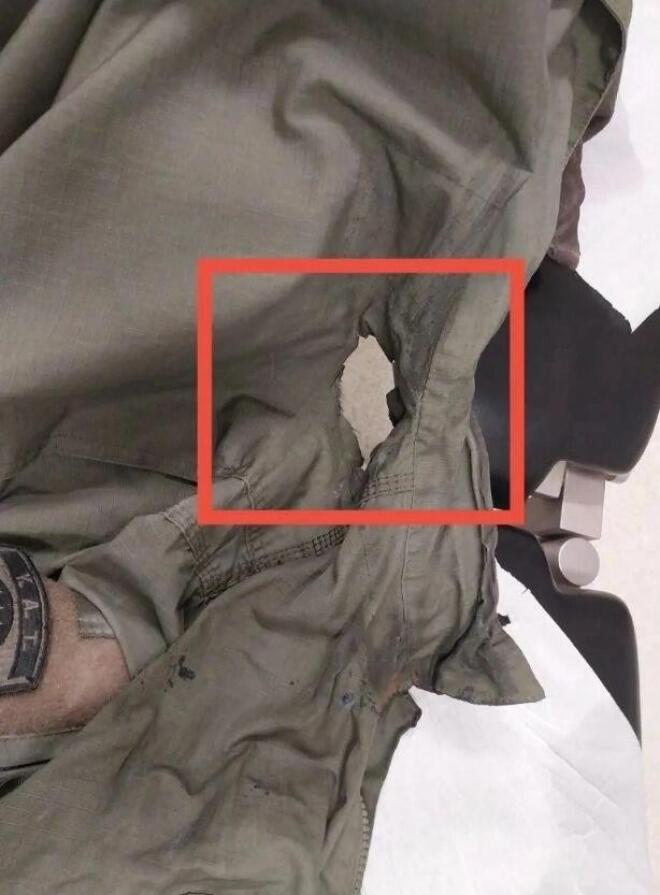 H φωτογραφία με την καμένη στολή του αστυνομικού, ο οποίος τραυματίστηκε στα επεισόδια έξω από το ΑΠΘ