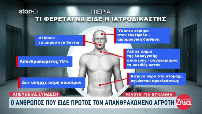 ιατροδικαστική έκθεση για 48χρονο που κάηκε στην Πιερία