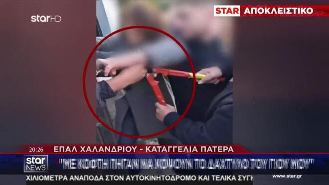 Καταγγελία πατέρα: «Με κόφτη πήγαν να κόψουν το δάκτυλο του γιου μου»