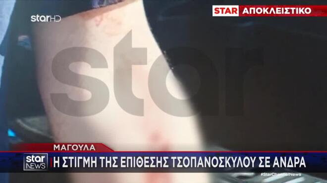 Επίθεση τσοπανόσκυλου