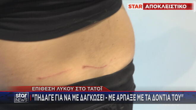 Επίθεση λύκου στο Τατόι