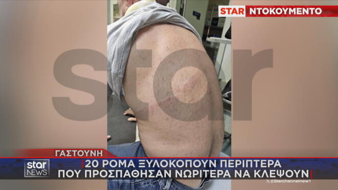 Περιπτεράς στη Γαστούνη δέχθηκε επίθεση