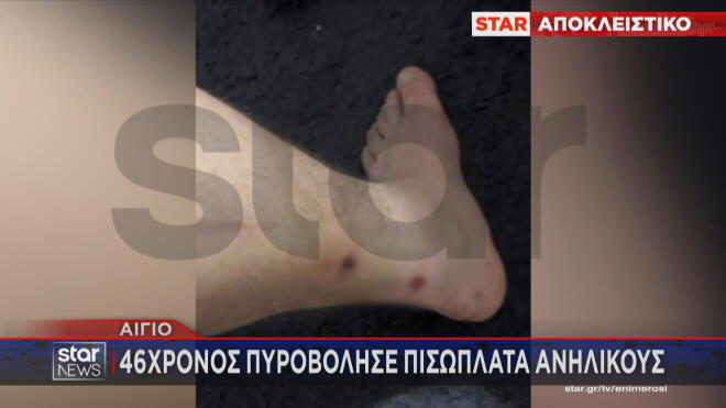 Συνελήφθη ένας 46χρονος που φέρεται να άνοιξε πυρ εναντίον παρέας ανηλίκων στο Αίγιο