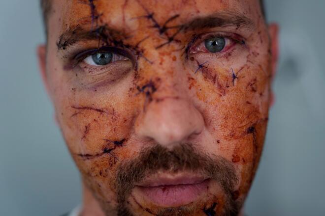 Θύμα του πολέμου 