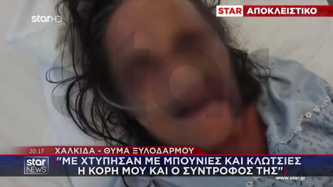 Χαλκίδα: Κόρη με τον σύντροφό της ξυλοκόπησαν τη μητέρα της 