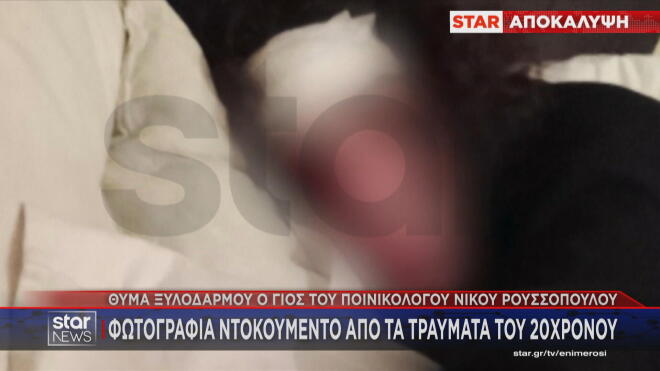 Θύμα ξυλοδαρμού ο γιος γνωστού ποινικολόγου