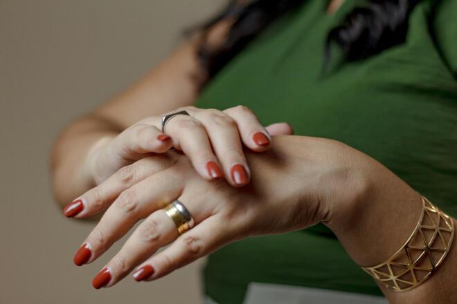 broken fingernails