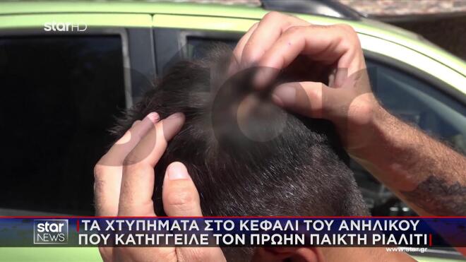 Γιώργος Παπαδόπουλος: Το τραύμα του 14χρονου στο κεφάλι\