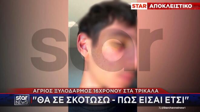 Τρίκαλα: Άγριος ξυλοδαρμός 16χρονου