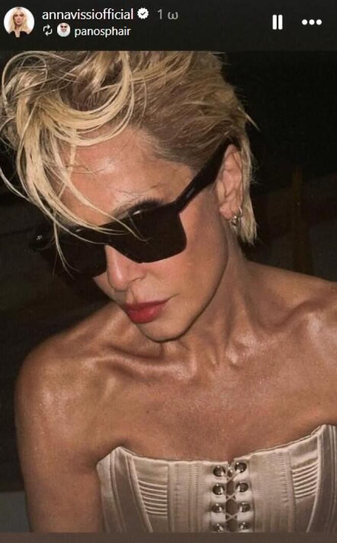 Άννα Βίσση: Το νέο «εκρηκτικό» hair look της απόλυτης σταρ!