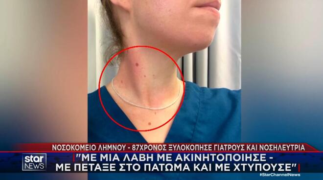 Ένα σοβαρό επεισόδιο βίας φέρεται να συνέβη στο νοσοκομείο της Λήμνου