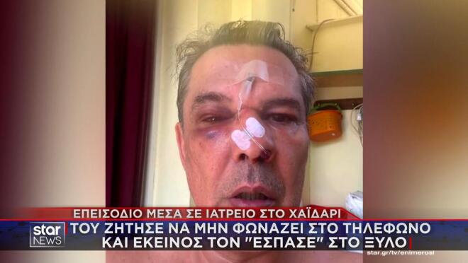 Θύμα άγριου ξυλοδαρμού έπεσε κουρέας στο Χαϊδάρι μέσα σε ιατρείο, από άλλον ασθενή.