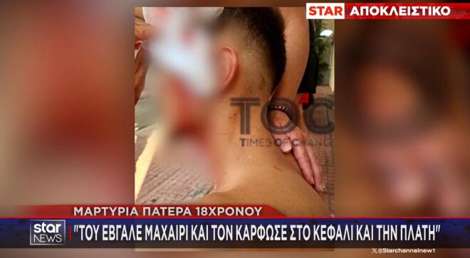 Αιματηρή απόπειρα ληστείας με θύμα έναν 18χρονο είχαμε στον Άγιο Δημήτριο.