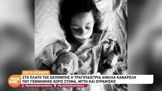 Αιμιλία Καναρέλη: Η τραγουδίστρια που γεννήθηκε χωρίς μύτη, στόμα, ουρανίσκο