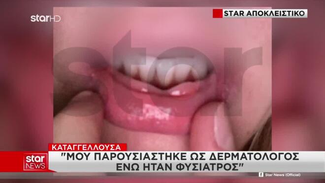 «Πήγα για καθαρισμό προσώπου και από τότε δε μπορώ να κλείσω το στόμα μου»