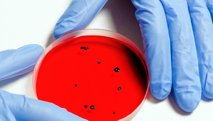 Λιστερίωση