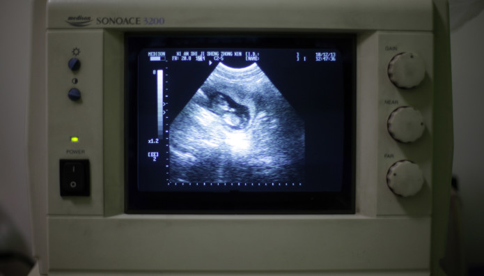 Κίνα: Γυναίκα Με Δύο Μήτρες Γέννησε Δίδυμα