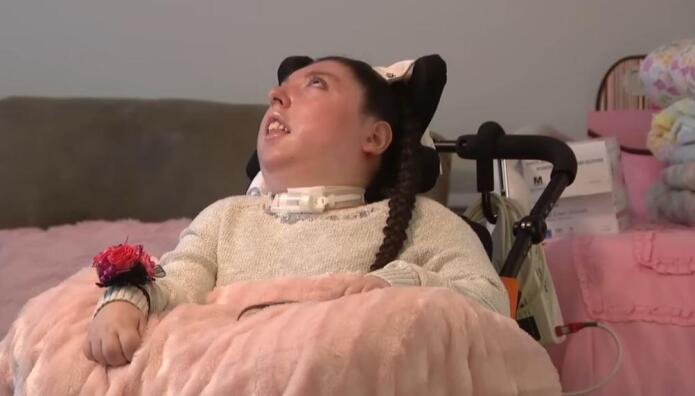 Κορίτσι Γεννήθηκε Χωρίς Εγκέφαλο Και Ζει 20 Χρόνια!