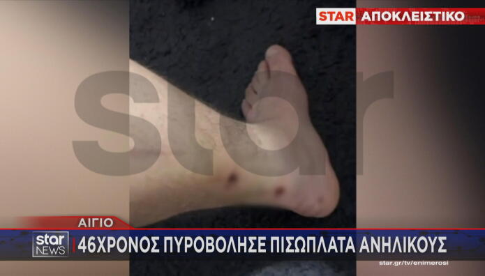 Αίγιο πυροβολισμοί