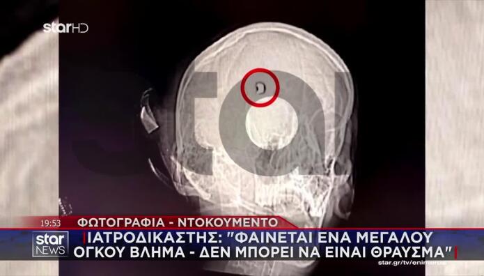 Άργος:Ένας Αστυνομικός Παραδέχεται Ότι Πυροβόλησε Στον Τοίχο