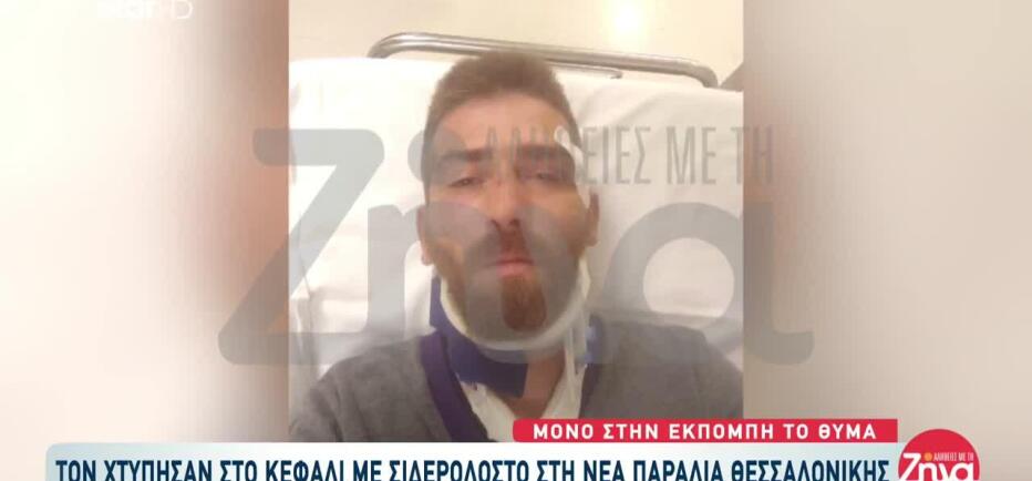 Θεσσαλονίκη: Τον Χτύπησαν Με Σιδηρολοστό Στο Κεφάλι Στη Νέα Παραλία