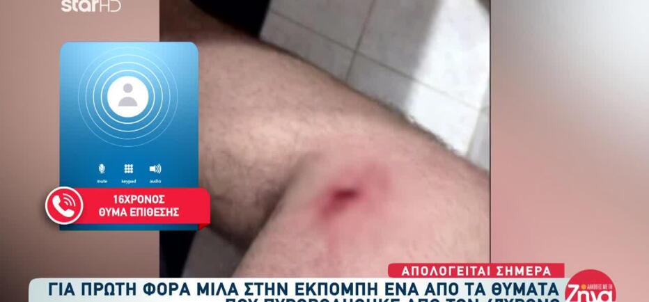 Αίγιο: Για Πρώτη Φορά Μιλά Θύμα Του 47χρονου