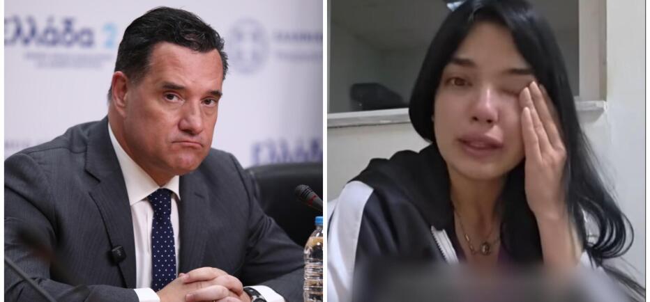 Γιατρός κατέρρευσε μετά από 5ήμερη εφημερία – Τι απαντά ο Άδωνις Γεωργιάδης