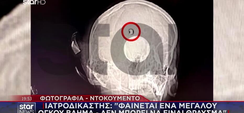 Άργος: Ο ένας αστυνομικός παραδέχεται ότι πυροβόλησε προς τον τοίχο