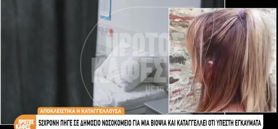 «Πήγα για βιοψία και έπαθα χημικά εγκαύματα δευτέρου βαθμού»